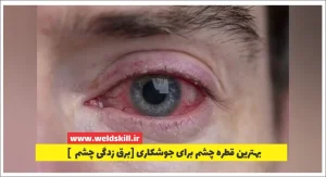 بهترین-قطره-چشم-برای-جوشکاری