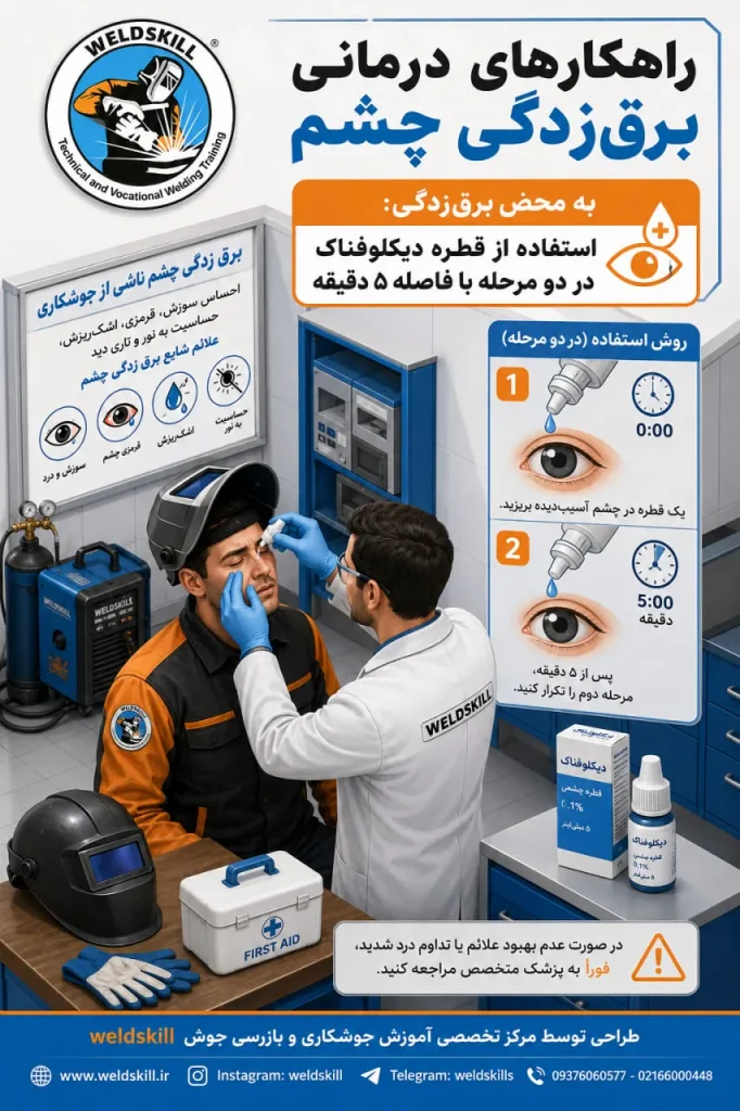 یک روش اورژانسی به محض برق زدگی چشم در زمان جوشکاری