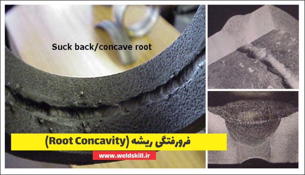 فرورفتگی ریشه (Root Concavity)