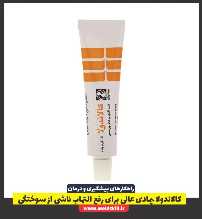 کالاندولا پمادی عالی برای رفع التهاب ناشی از سوختگی
