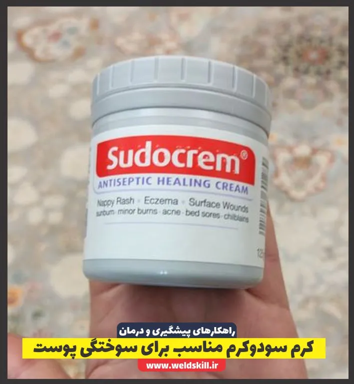 کرم سودوکرم مناسب برای سوختگی پوست