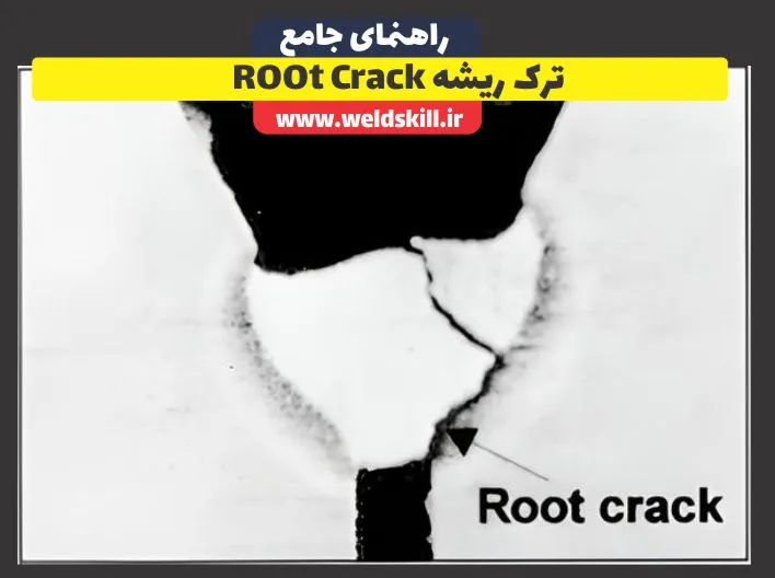 ترک ریشه Root Crack