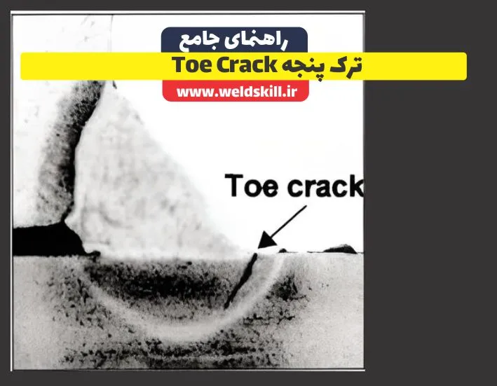 ترک پنجه Toe Crack