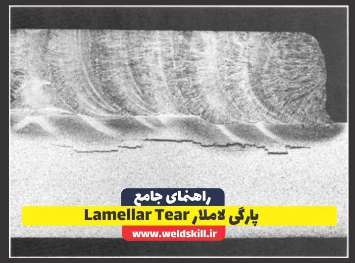پارگی لاملار Lamellar Tear